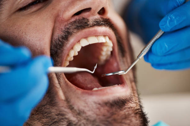 Best Emergency Dentist for Knocked-Out Tooth in Emigsville, PA